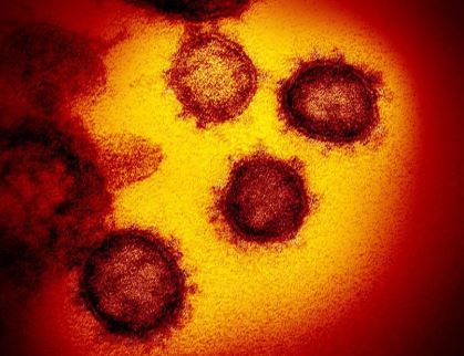 https://www.yenicaggazetesi.com.tr/d/other/coronavirus12.JPG